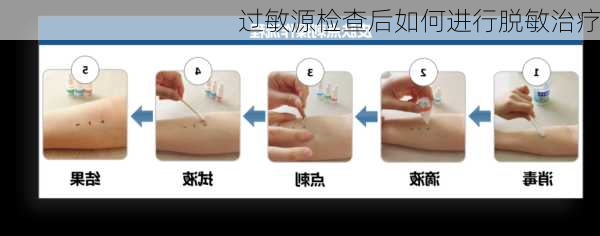 过敏源检查后如何进行脱敏治疗