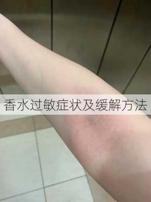 香水过敏症状及缓解方法